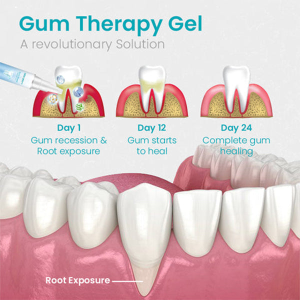 Christmas Pre-sale 80% OFF-NESLEMY™ Gum Shield Therapy Gel