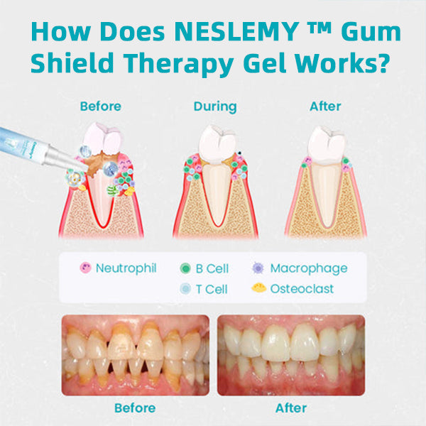 Christmas Pre-sale 80% OFF-NESLEMY™ Gum Shield Therapy Gel